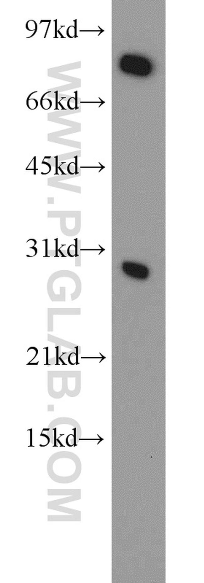 CBX5 Antibody in Western Blot (WB)