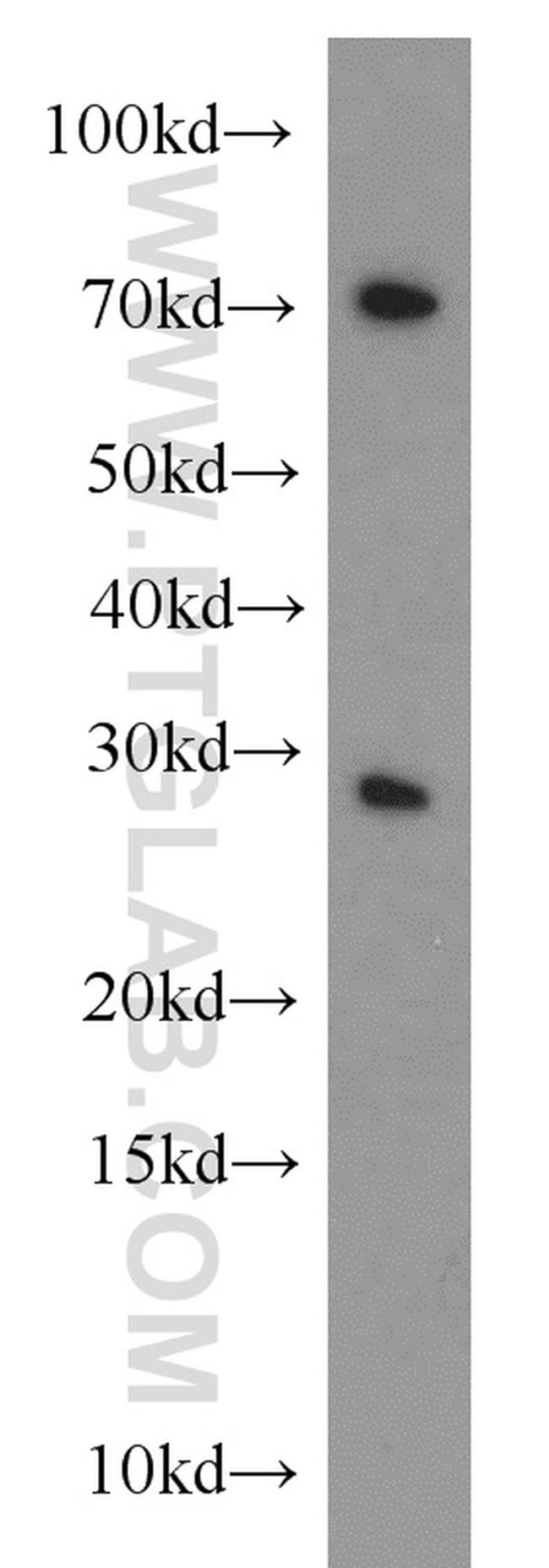 CBX5 Antibody in Western Blot (WB)