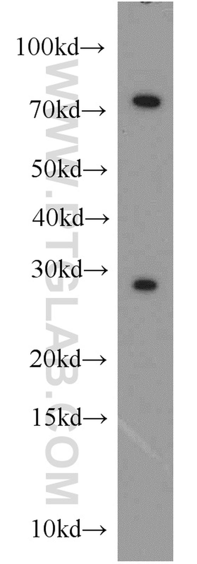 CBX5 Antibody in Western Blot (WB)