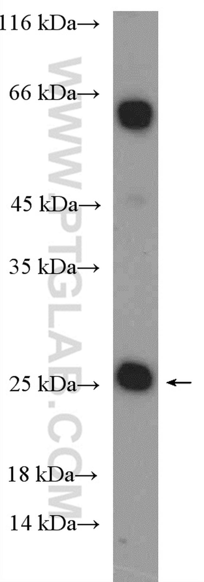 CBX5 Antibody in Western Blot (WB)