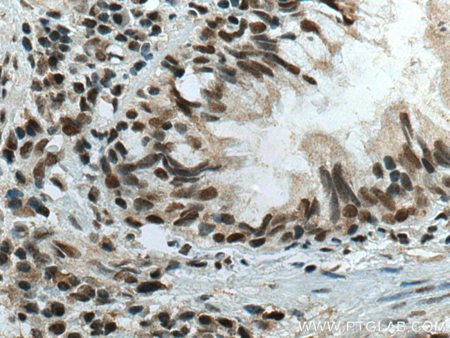 CBX5 Antibody in Immunohistochemistry (Paraffin) (IHC (P))