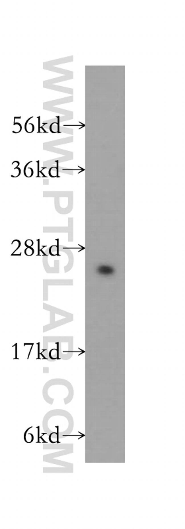 UBE2K Antibody in Western Blot (WB)