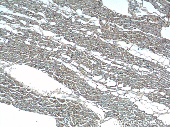 OLR1 Antibody in Immunohistochemistry (Paraffin) (IHC (P))