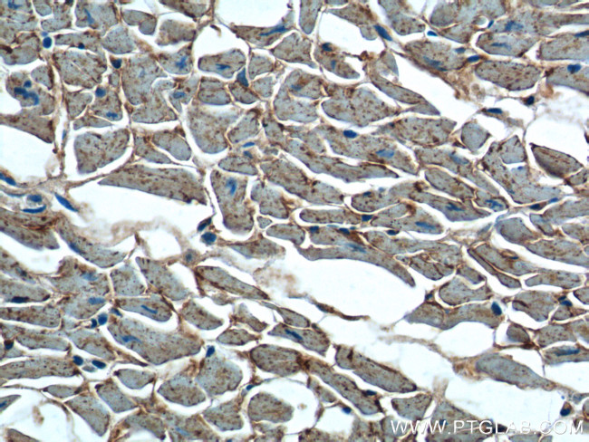 OLR1 Antibody in Immunohistochemistry (Paraffin) (IHC (P))