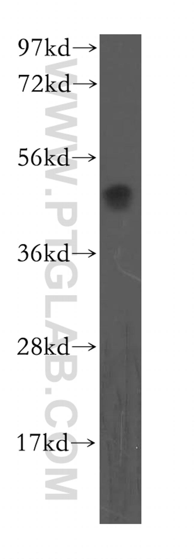 OLR1 Antibody in Western Blot (WB)