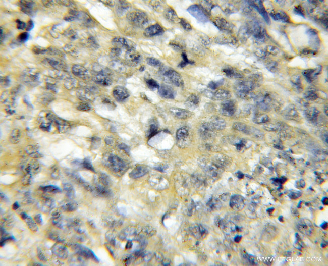 Surfactant protein D Antibody in Immunohistochemistry (Paraffin) (IHC (P))