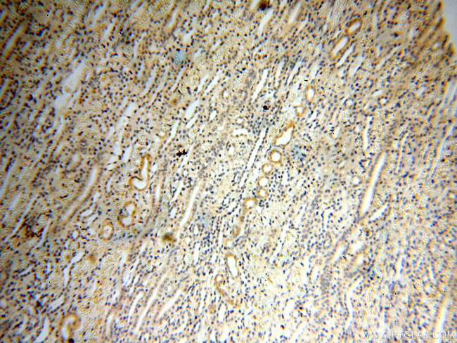 Surfactant protein D Antibody in Immunohistochemistry (Paraffin) (IHC (P))