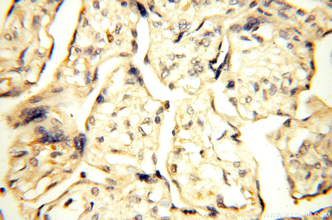 Surfactant protein D Antibody in Immunohistochemistry (Paraffin) (IHC (P))