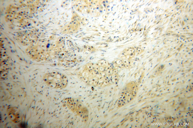 SDCCAG1 Antibody in Immunohistochemistry (Paraffin) (IHC (P))