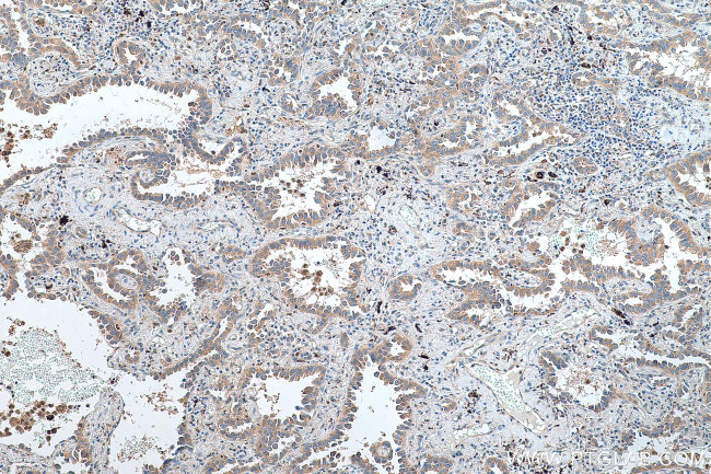 SDCCAG1 Antibody in Immunohistochemistry (Paraffin) (IHC (P))