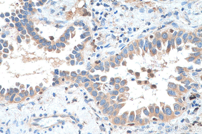 SDCCAG1 Antibody in Immunohistochemistry (Paraffin) (IHC (P))