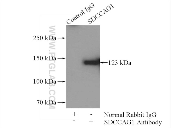 SDCCAG1 Antibody in Immunoprecipitation (IP)