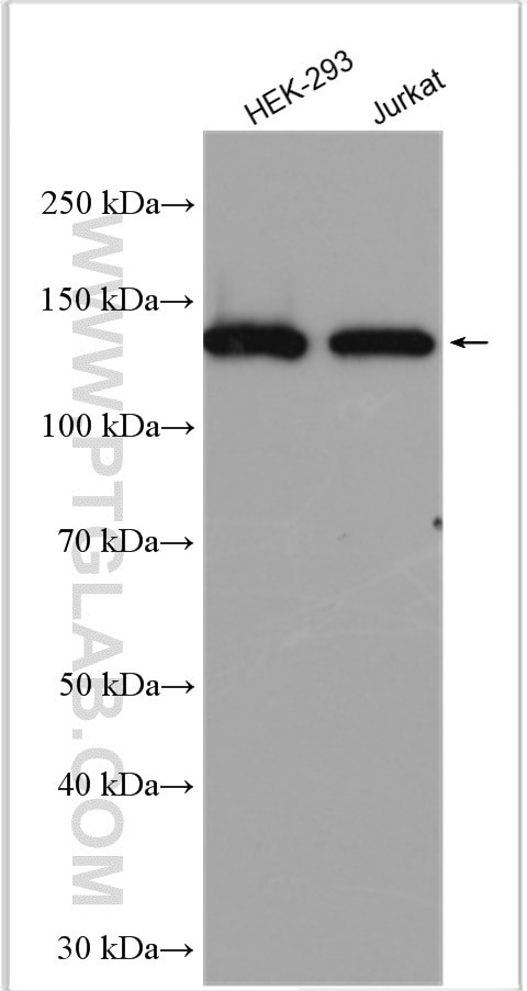 SDCCAG1 Antibody in Western Blot (WB)