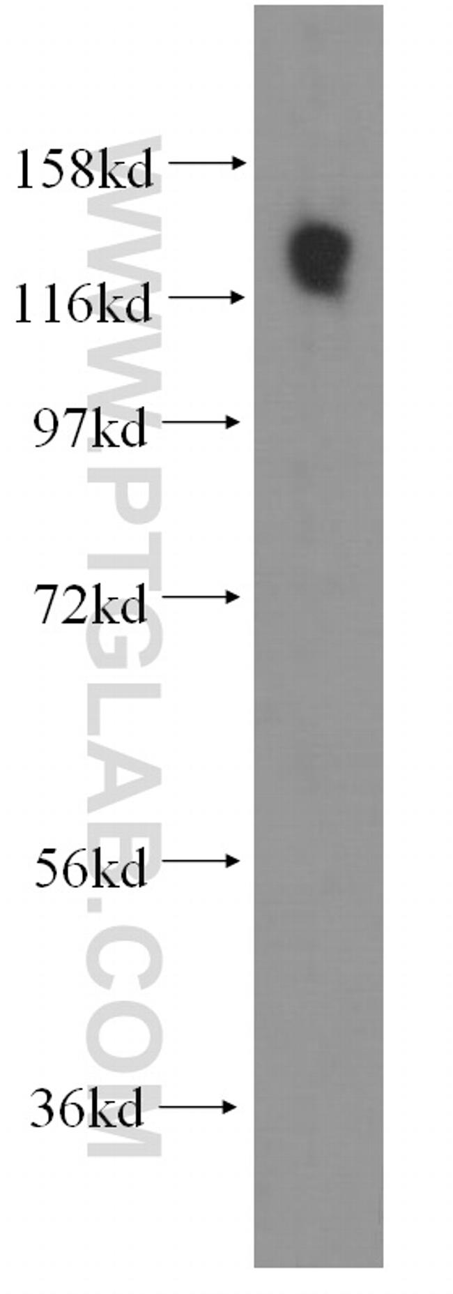 SDCCAG1 Antibody in Western Blot (WB)