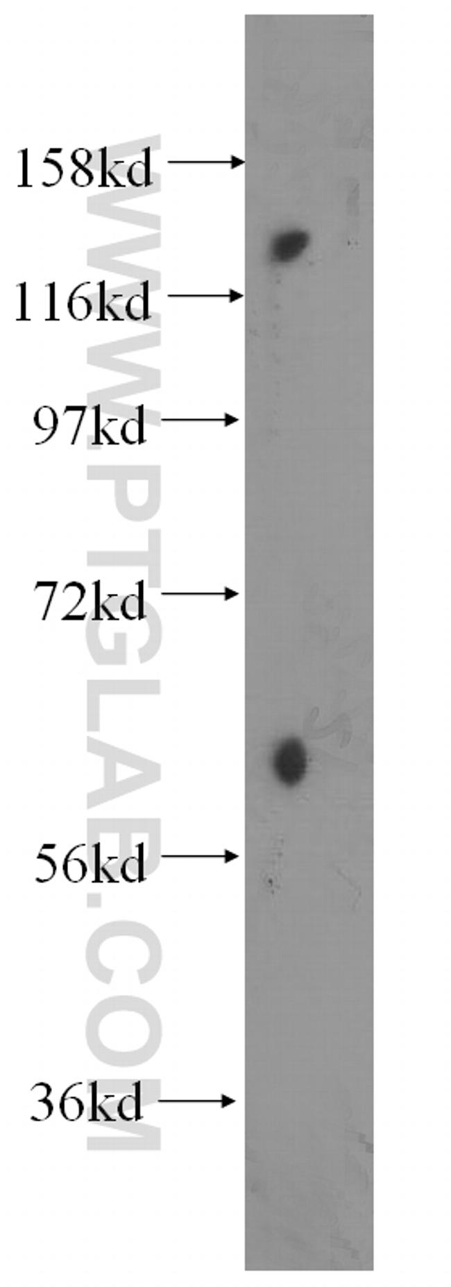 SDCCAG1 Antibody in Western Blot (WB)