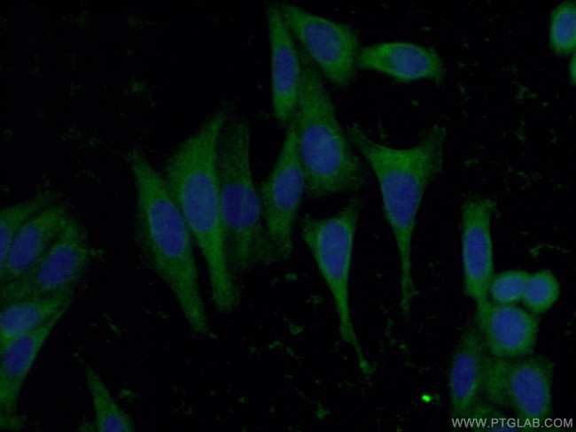 RBP5 Antibody in Immunocytochemistry (ICC/IF)