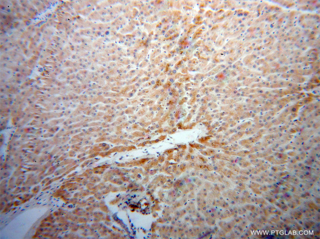 RBP5 Antibody in Immunohistochemistry (Paraffin) (IHC (P))