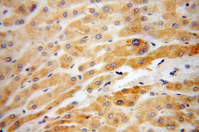 RBP5 Antibody in Immunohistochemistry (Paraffin) (IHC (P))