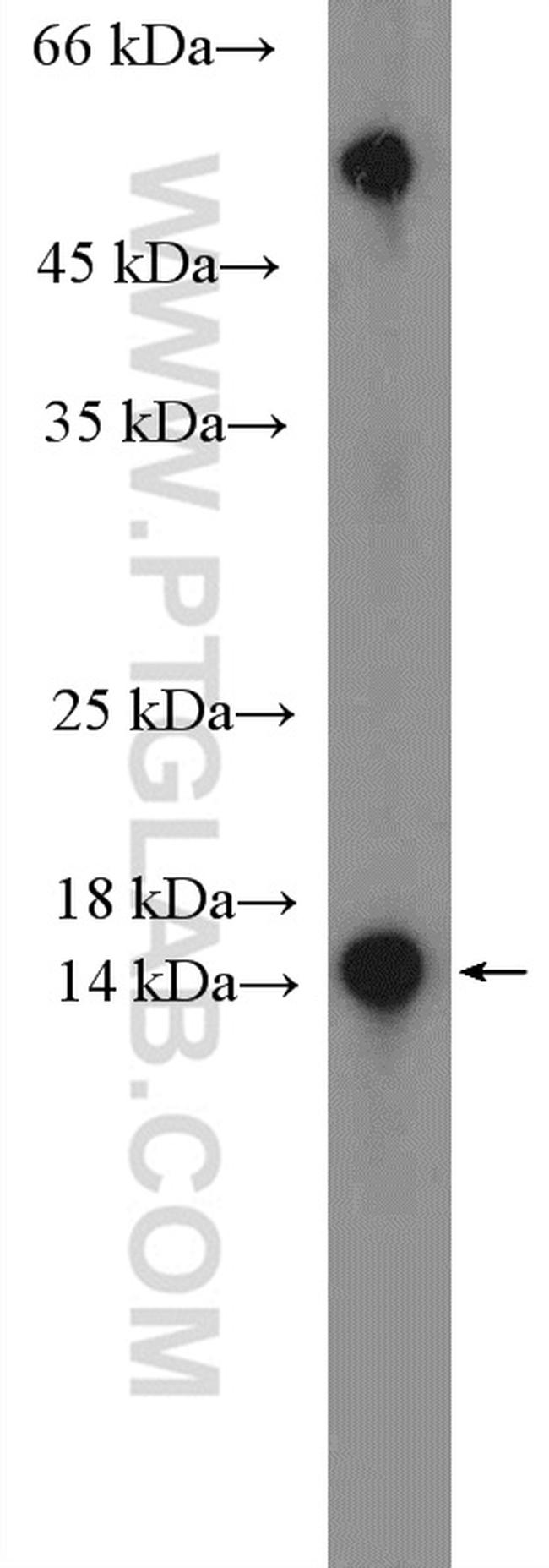 RBP5 Antibody in Western Blot (WB)