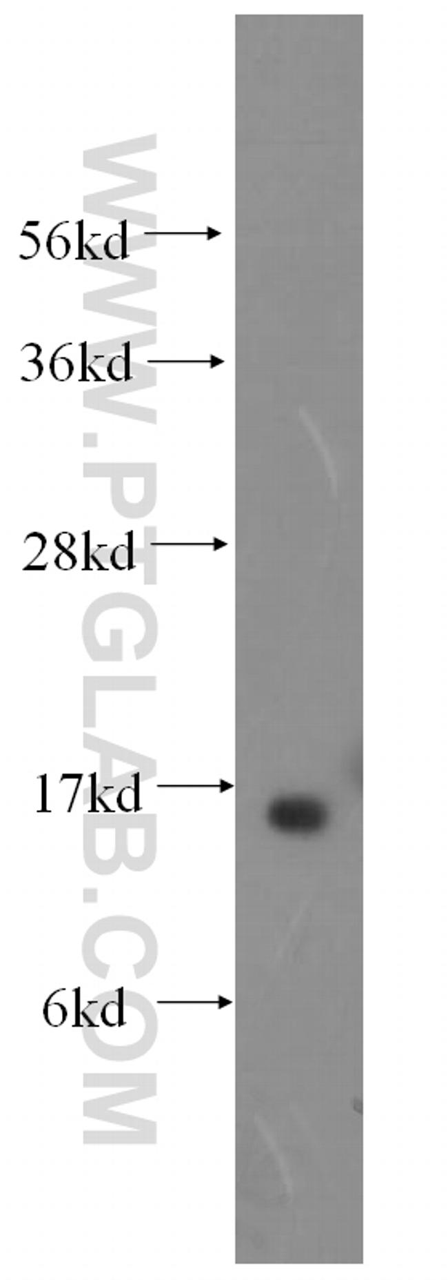 RBP5 Antibody in Western Blot (WB)