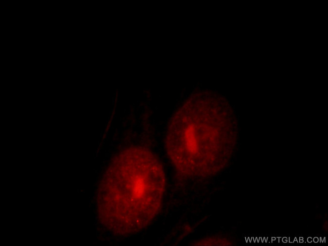 UBE2E2 Antibody in Immunocytochemistry (ICC/IF)