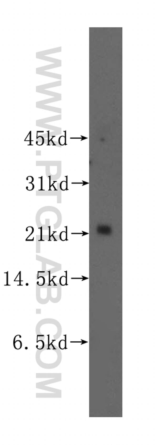 UBE2E2 Antibody in Western Blot (WB)