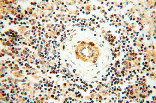 SRPX2 Antibody in Immunohistochemistry (Paraffin) (IHC (P))