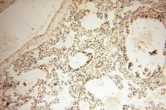 SRPX2 Antibody in Immunohistochemistry (Paraffin) (IHC (P))