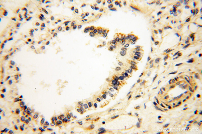 SRPX2 Antibody in Immunohistochemistry (Paraffin) (IHC (P))