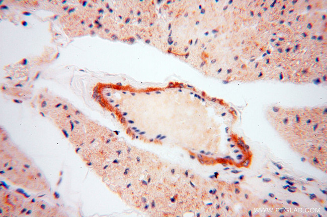 SRPX2 Antibody in Immunohistochemistry (Paraffin) (IHC (P))