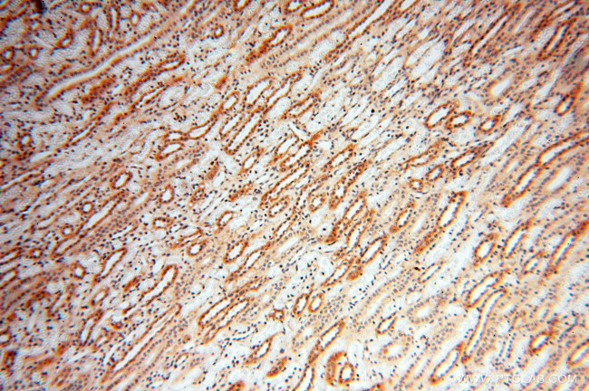 SRPX2 Antibody in Immunohistochemistry (Paraffin) (IHC (P))