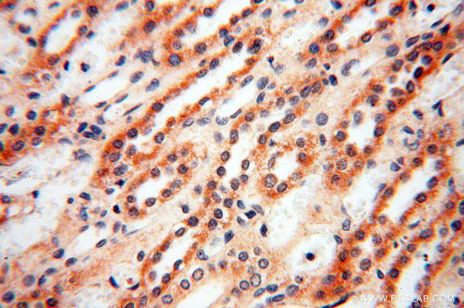 SRPX2 Antibody in Immunohistochemistry (Paraffin) (IHC (P))