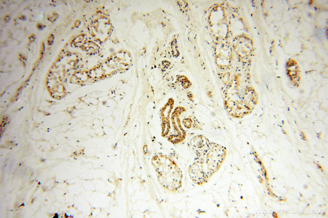 SRPX2 Antibody in Immunohistochemistry (Paraffin) (IHC (P))