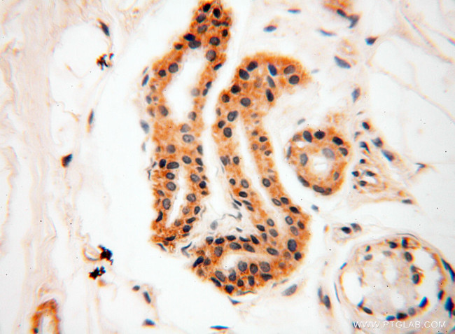 SRPX2 Antibody in Immunohistochemistry (Paraffin) (IHC (P))