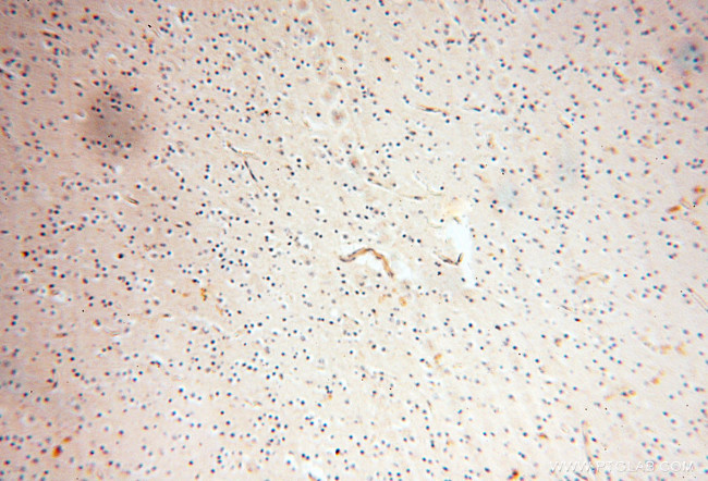 SRPX2 Antibody in Immunohistochemistry (Paraffin) (IHC (P))