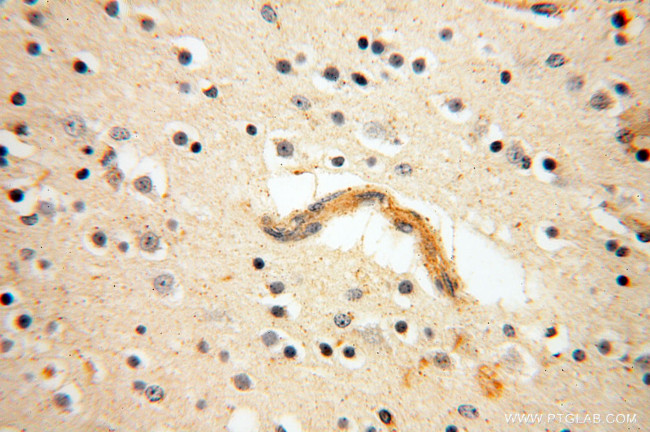 SRPX2 Antibody in Immunohistochemistry (Paraffin) (IHC (P))