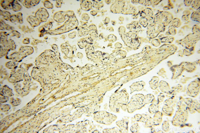 SRPX2 Antibody in Immunohistochemistry (Paraffin) (IHC (P))