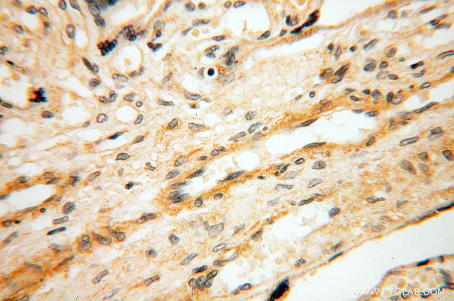 SRPX2 Antibody in Immunohistochemistry (Paraffin) (IHC (P))