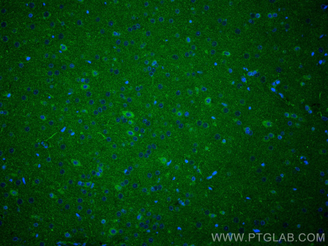 SRPX2 Antibody in Immunohistochemistry (PFA fixed) (IHC (PFA))