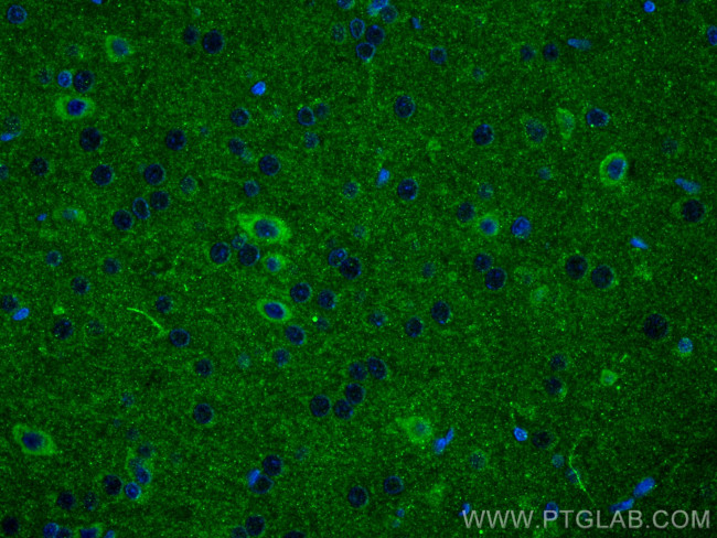 SRPX2 Antibody in Immunohistochemistry (PFA fixed) (IHC (PFA))