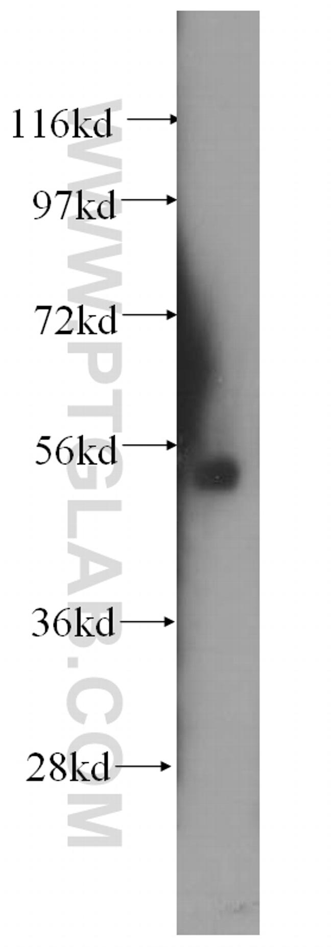 SRPX2 Antibody in Western Blot (WB)