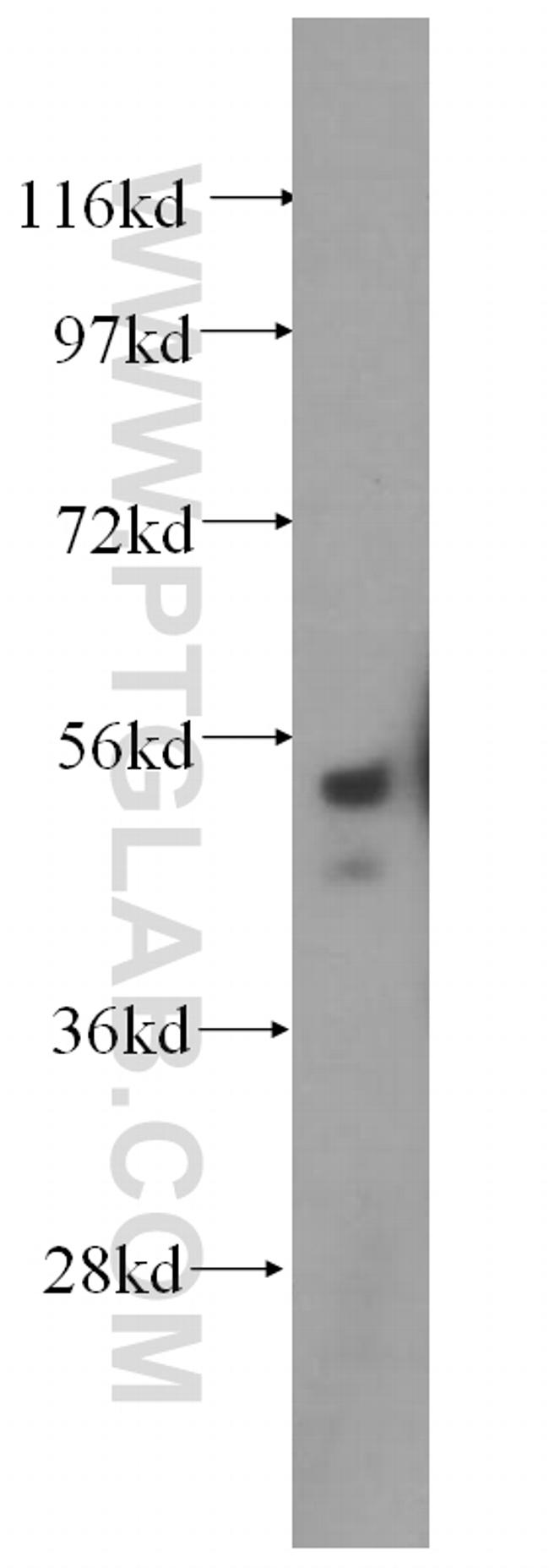 SRPX2 Antibody in Western Blot (WB)