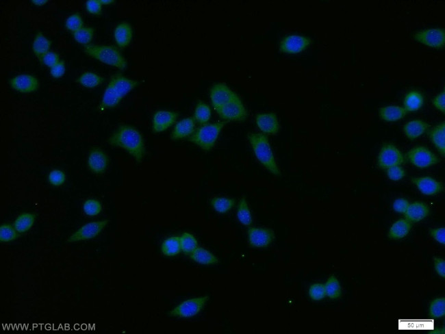 SPCS1 Antibody in Immunocytochemistry (ICC/IF)