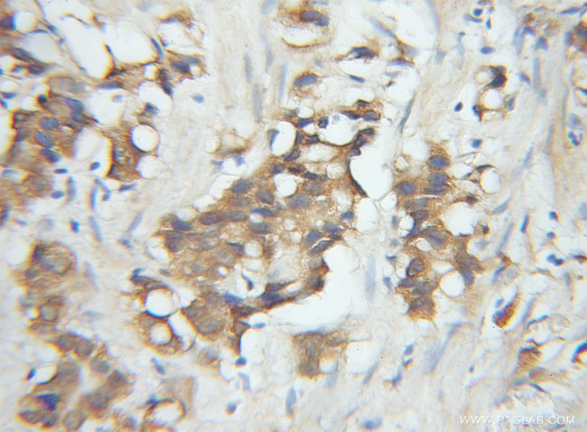 SPCS1 Antibody in Immunohistochemistry (Paraffin) (IHC (P))