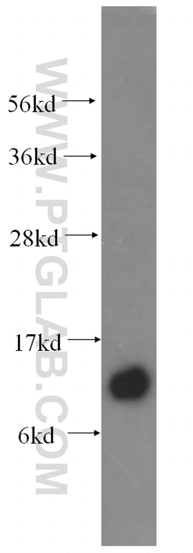 SPCS1 Antibody in Western Blot (WB)