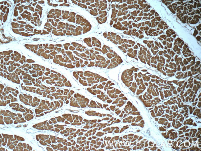 Cofilin 2 Antibody in Immunohistochemistry (Paraffin) (IHC (P))