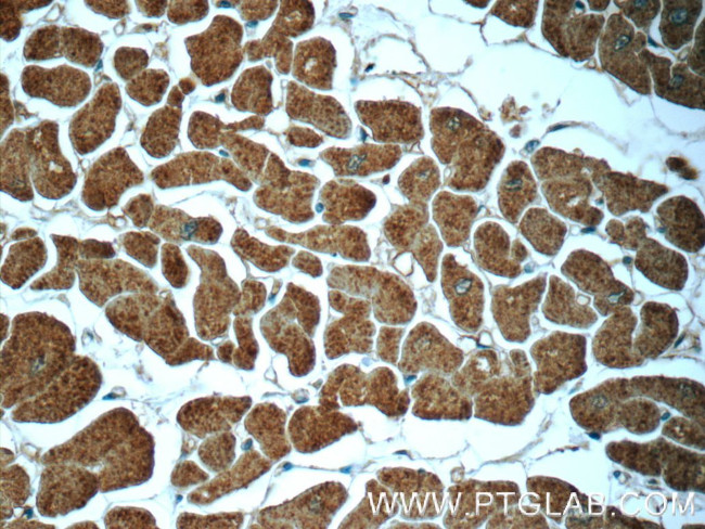 Cofilin 2 Antibody in Immunohistochemistry (Paraffin) (IHC (P))