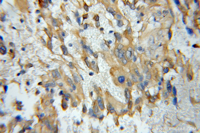 Cofilin 2 Antibody in Immunohistochemistry (Paraffin) (IHC (P))