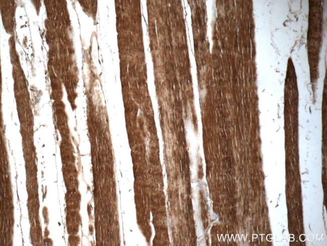 Cofilin 2 Antibody in Immunohistochemistry (Paraffin) (IHC (P))