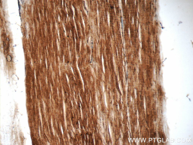 Cofilin 2 Antibody in Immunohistochemistry (Paraffin) (IHC (P))